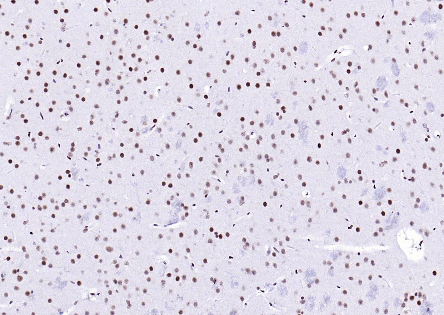 YY1 Nuclear Loading Control Antibody (3P967)