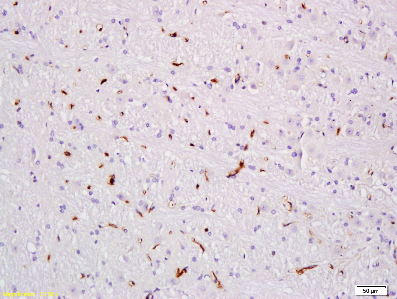 Anti-VEGFA Polyclonal Antibody 2