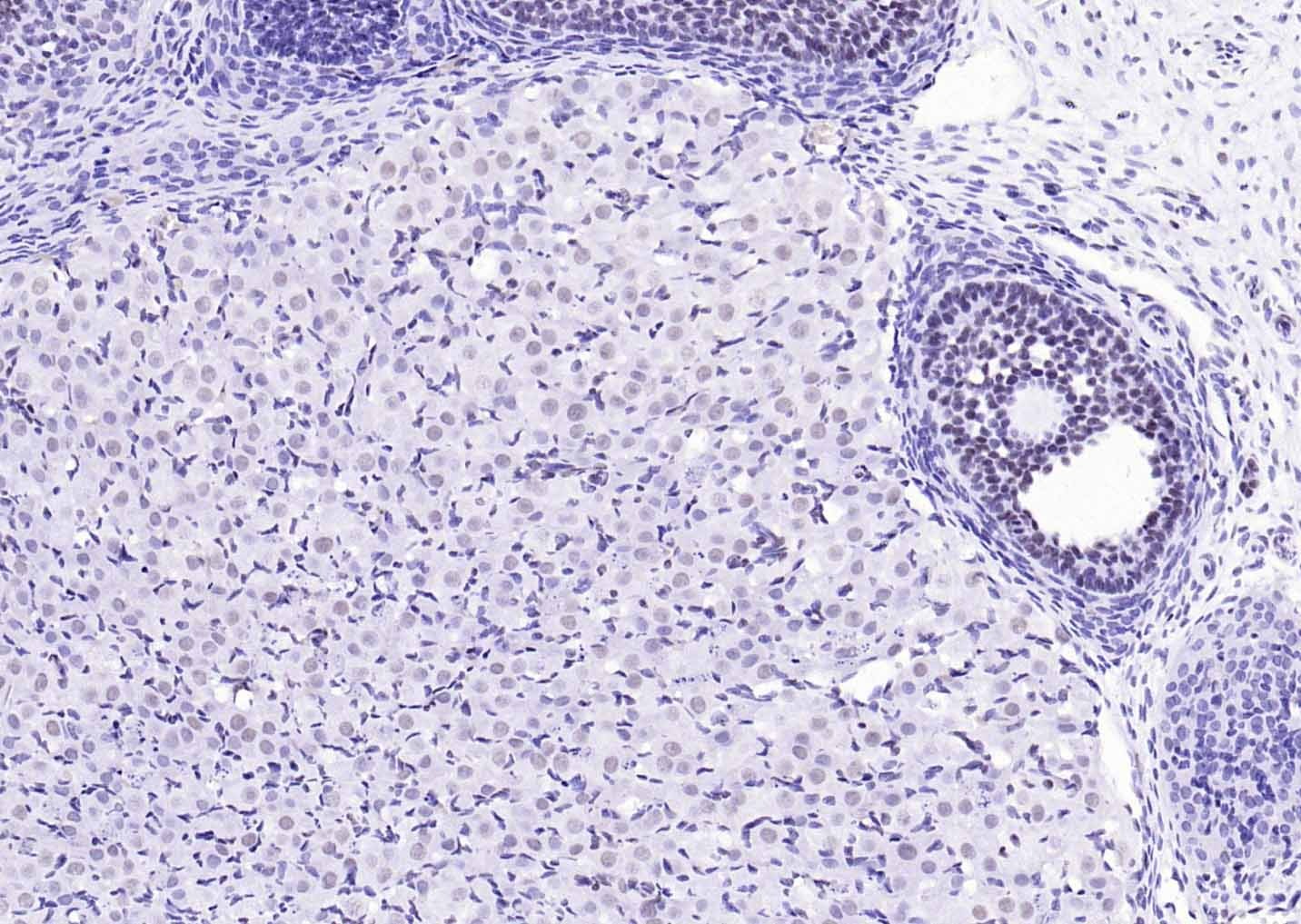 YY1 Nuclear Loading Control Antibody (3P967)