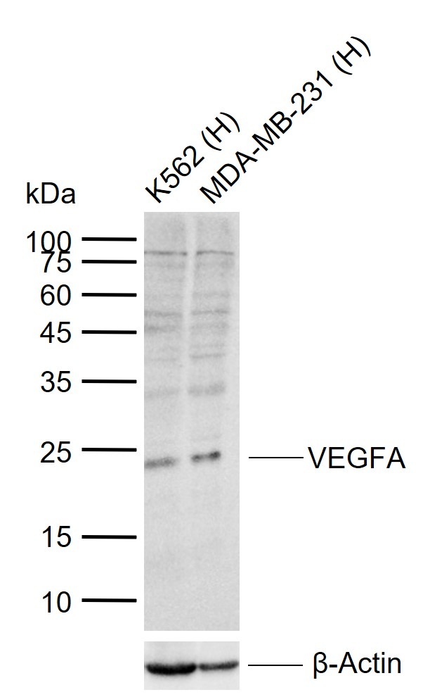 Anti-VEGFA Polyclonal Antibody 5