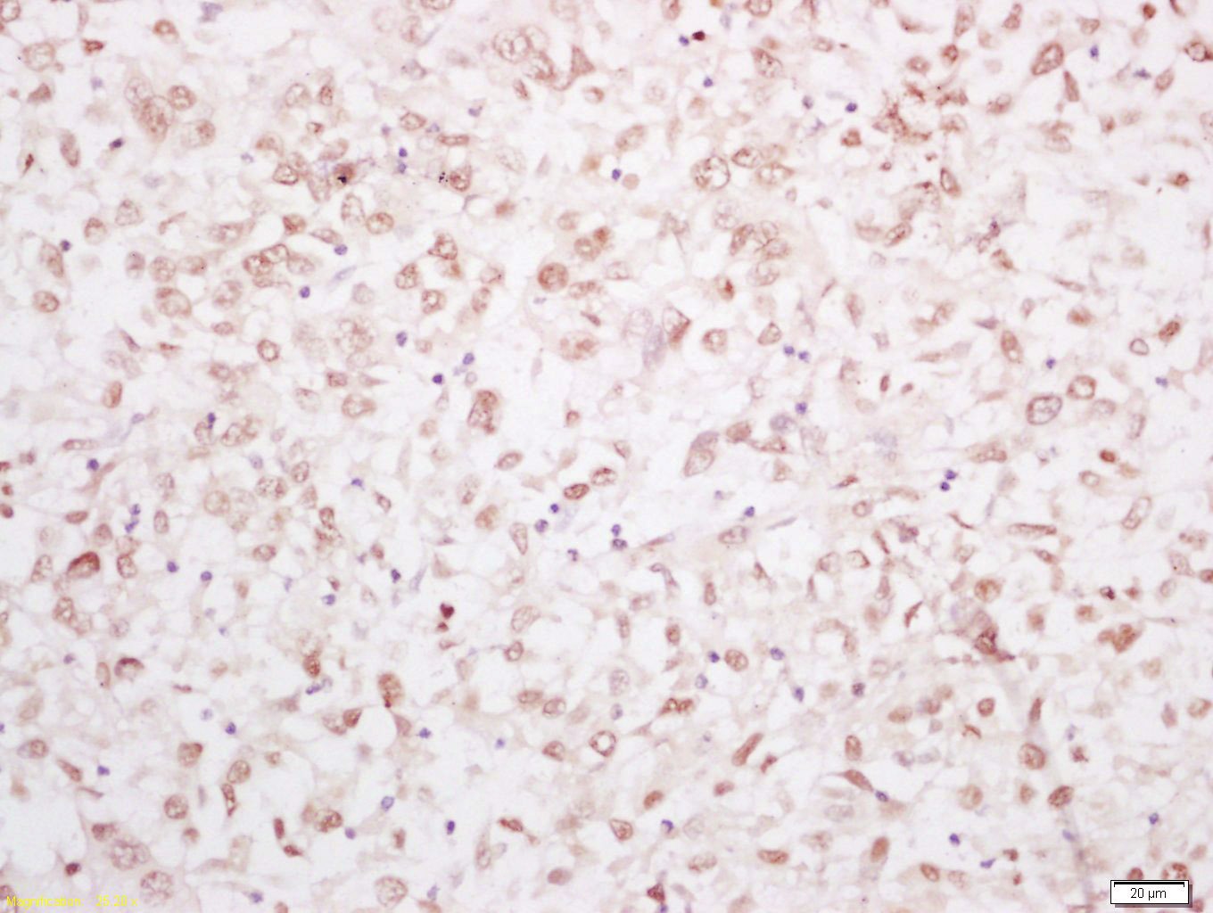 Anti-YAP1 Polyclonal Antibody