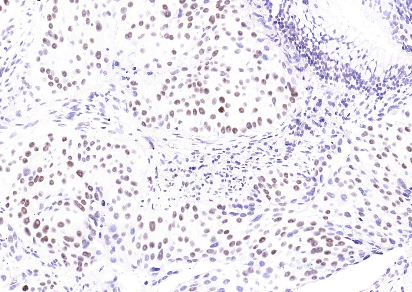 YY1 Nuclear Loading Control Antibody (3P967)