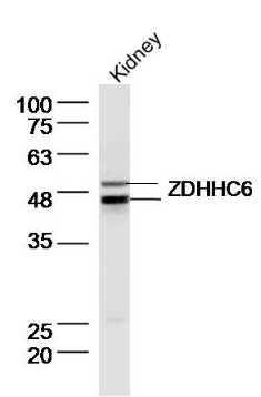 Anti-ZDHHC6 Polyclonal Antibody