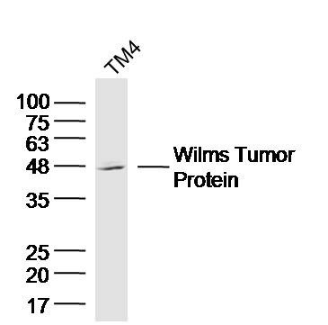 Anti-Wilms tumor/WT1 Polyclonal Antibody