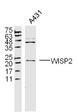 Anti-WISP2/CCN5 Polyclonal Antibody
