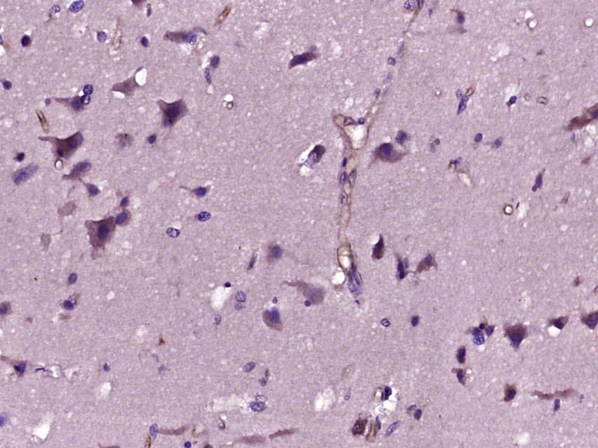 Anti-WISP2/CCN5 Polyclonal Antibody