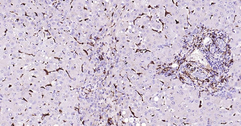 Anti-CD163 Antibody (5V810)