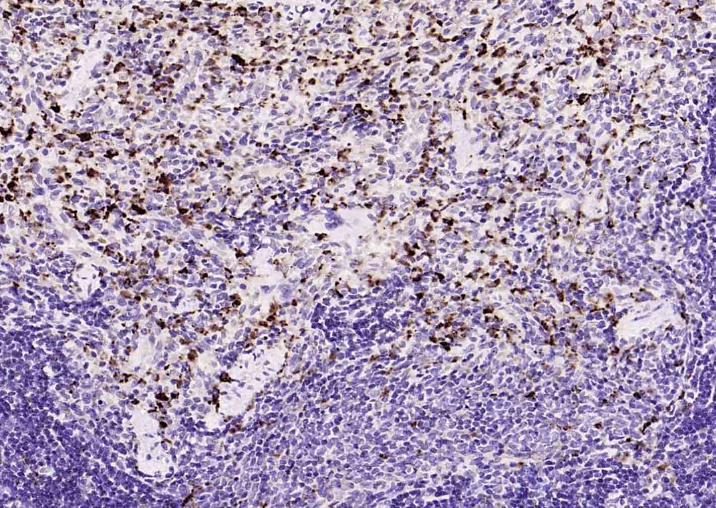 Anti-CD68 Antibody (8F211)