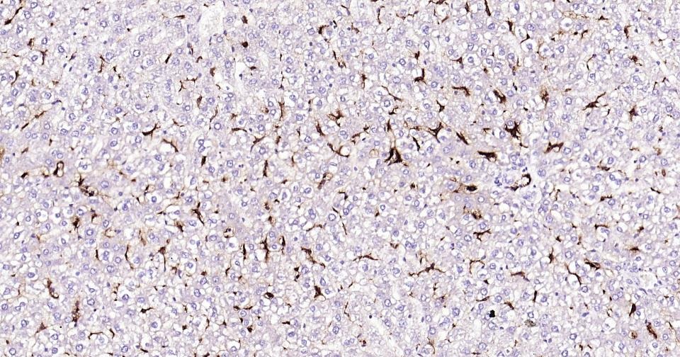 Anti-CD163 Antibody (5V810)