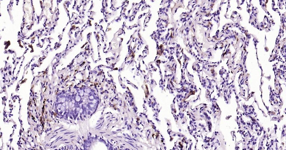 Anti-CD163 Antibody (5V810)