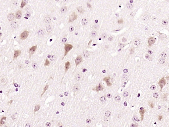 Anti-CD155/PVR Polyclonal Antibody