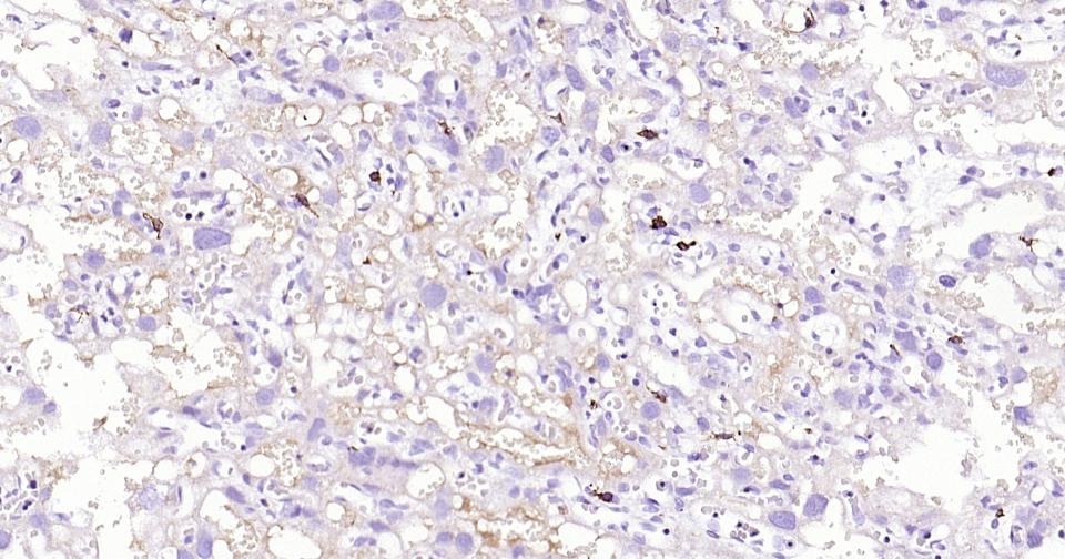 Anti-CD163 Antibody (5V810)