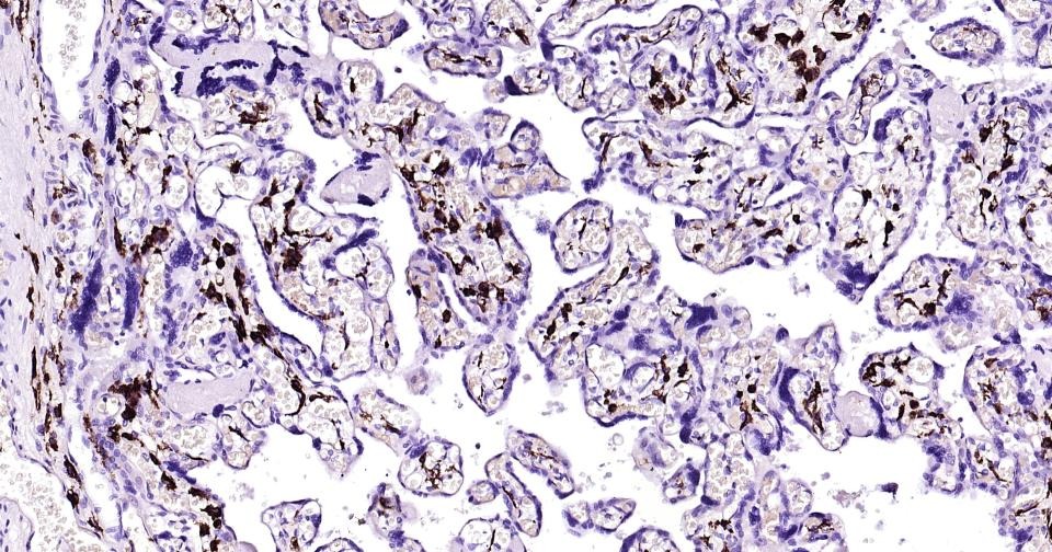 Anti-CD163 Antibody (5V810)