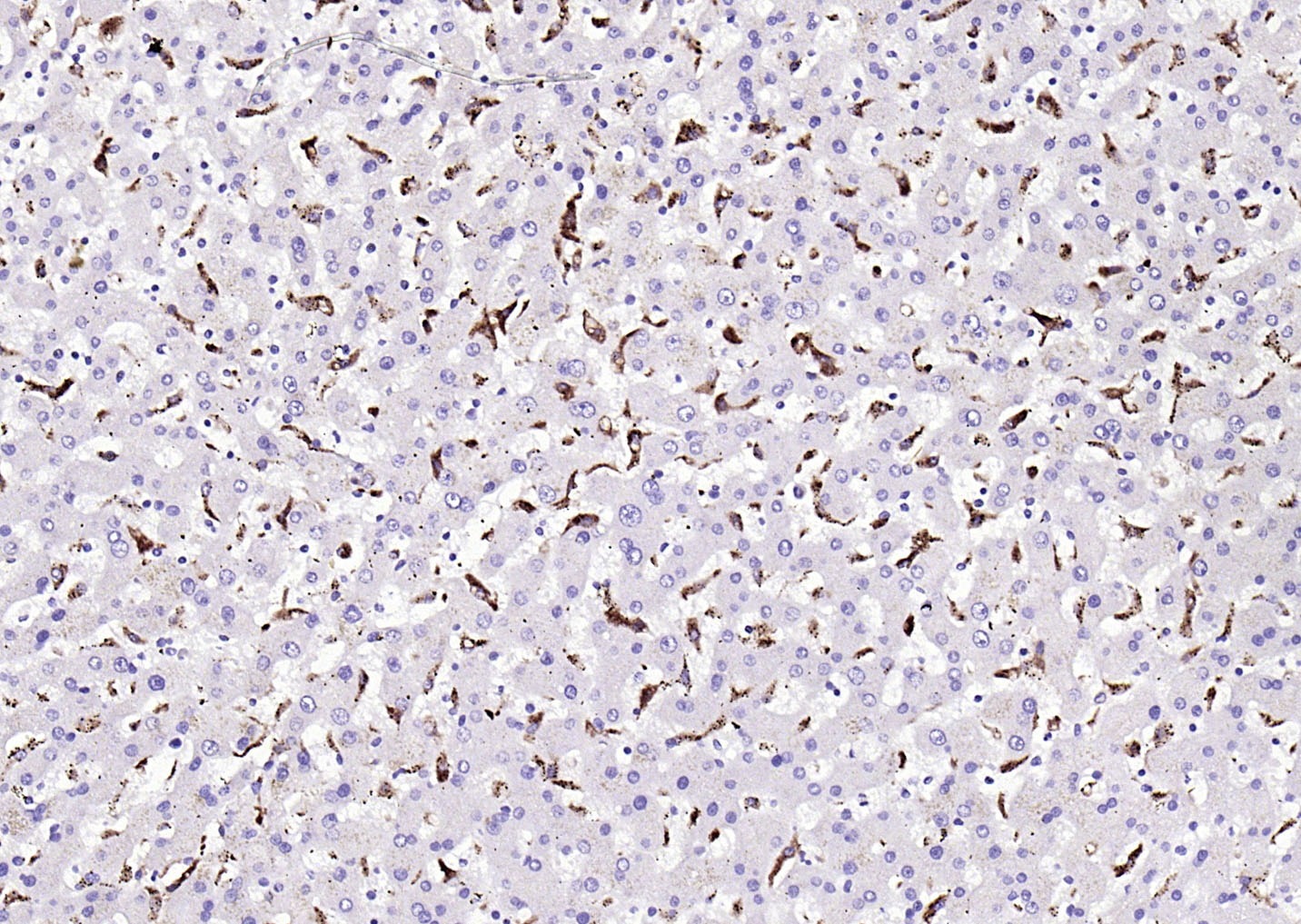 Anti-CD68 Antibody (8F211)