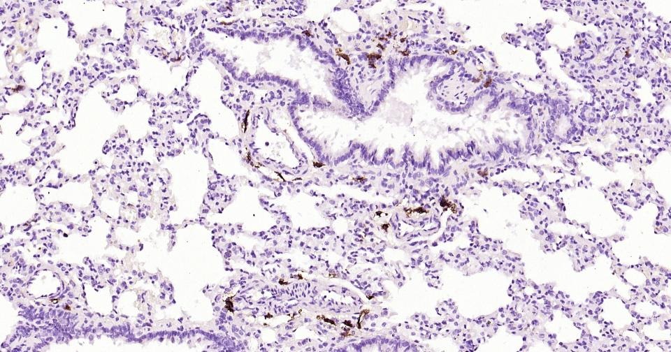 Anti-CD163 Antibody (5V810)
