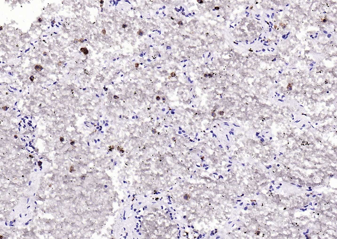 Anti-CD68 Polyclonal Antibody