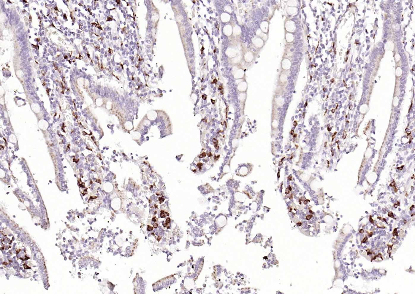 Anti-CD68 Polyclonal Antibody