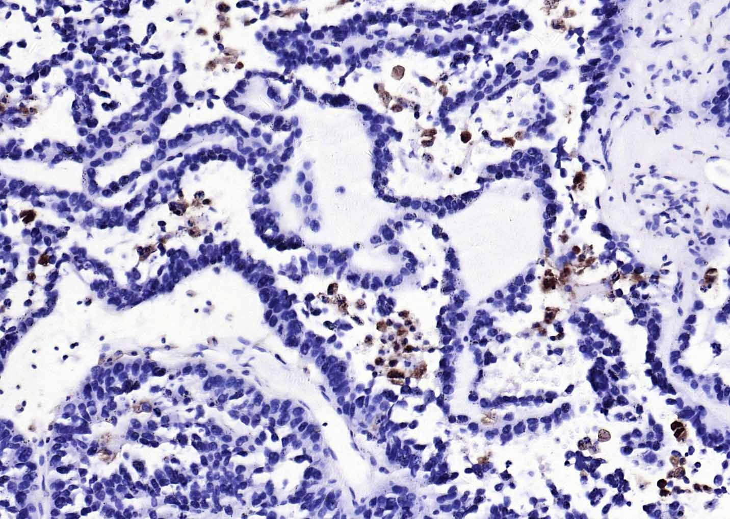Anti-CD68 Polyclonal Antibody
