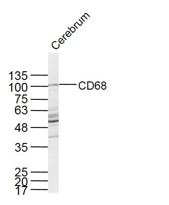 Anti-CD68 Polyclonal Antibody 3