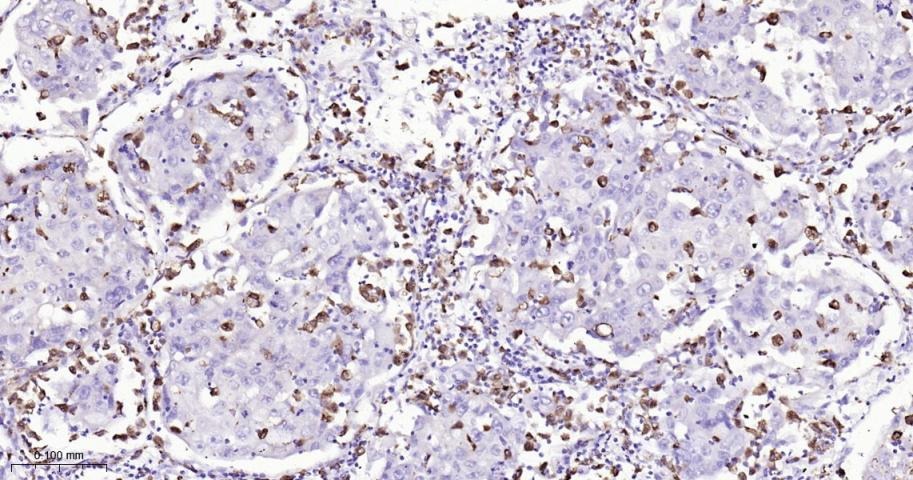 Anti-CD68 Antibody (2P747)