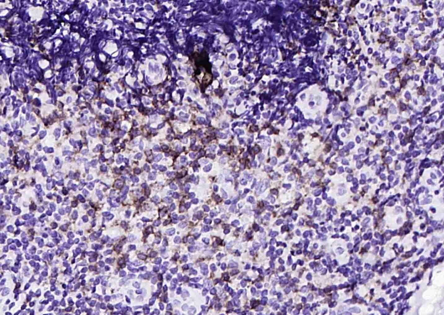 Anti-CD8 alpha Antibody (9O552)