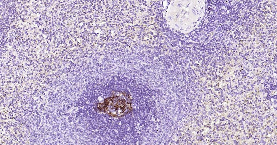 Anti-CD23 Antibody (4R869)