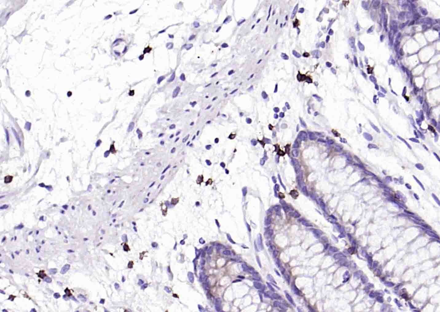 Anti-CD8 alpha Antibody (9O552)