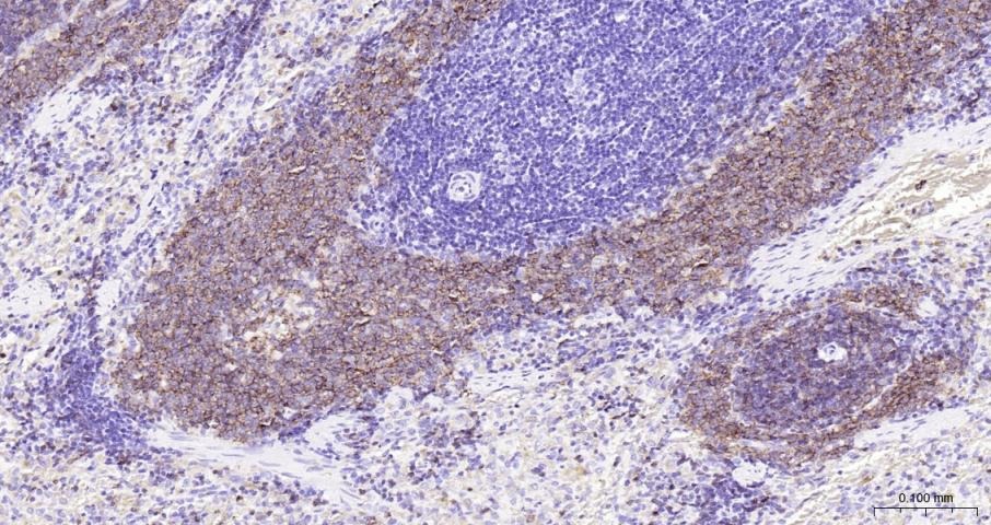 Anti-CD20 Antibody (1R324)