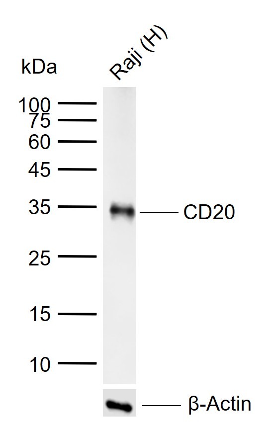 Anti-CD20 Antibody (1R324)