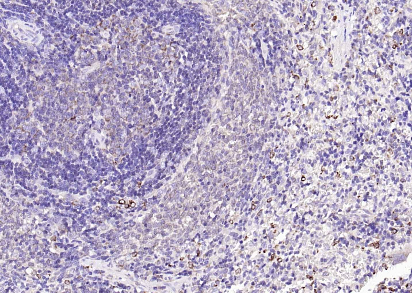 Anti-CD74 Polyclonal Antibody