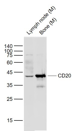 Anti-CD20 Polyclonal Antibody