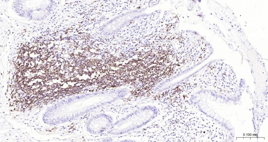 Anti-CD20 Antibody (1R324)