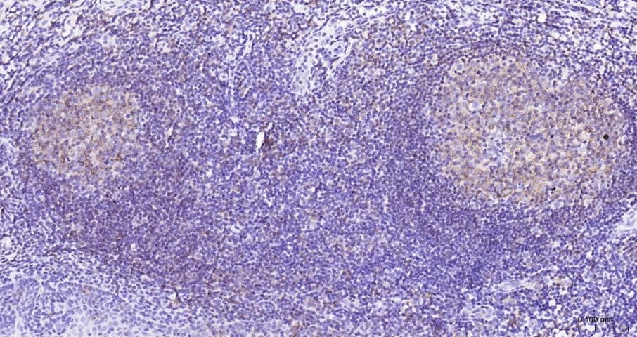 Anti-CD20 Antibody (1R324)