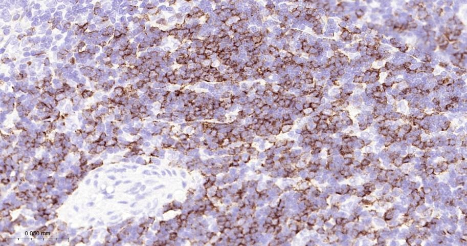 Anti-CD8 alpha Polyclonal Antibody 2