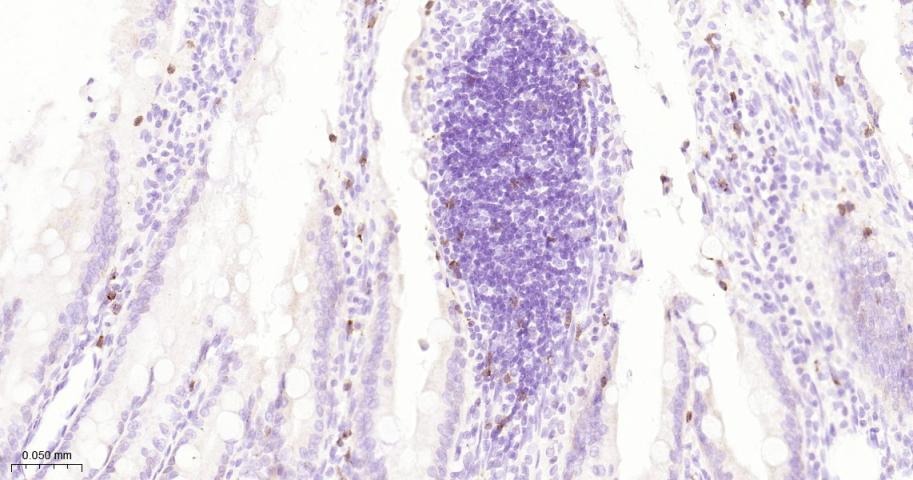 Anti-CD8 alpha Polyclonal Antibody 2