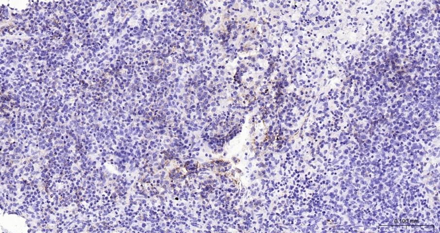 Anti-CD20 Antibody (1R324)