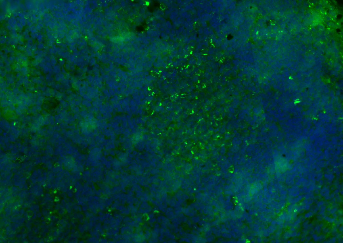 Anti-CD8 beta Polyclonal Antibody