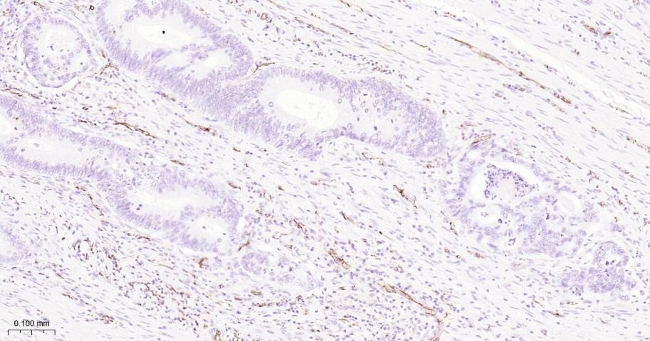 Anti-CD31 Antibody (2K688)