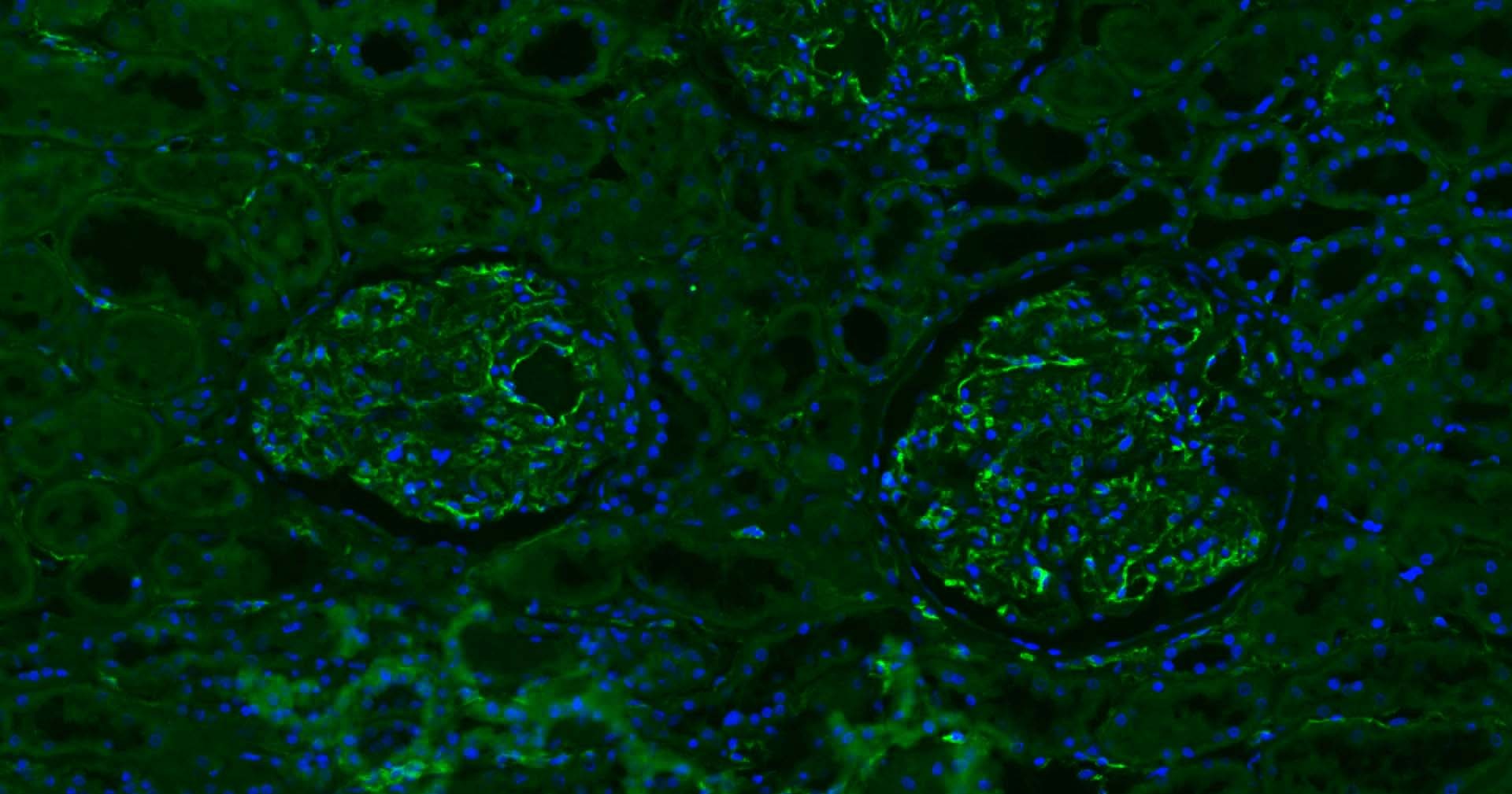 Anti-CD31 Antibody (2K688)