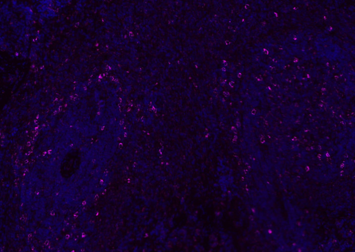 Anti-CD8 beta Polyclonal Antibody