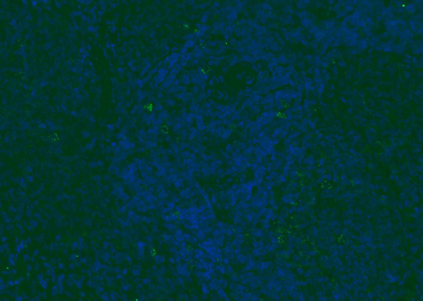 Anti-CD8 beta Polyclonal Antibody