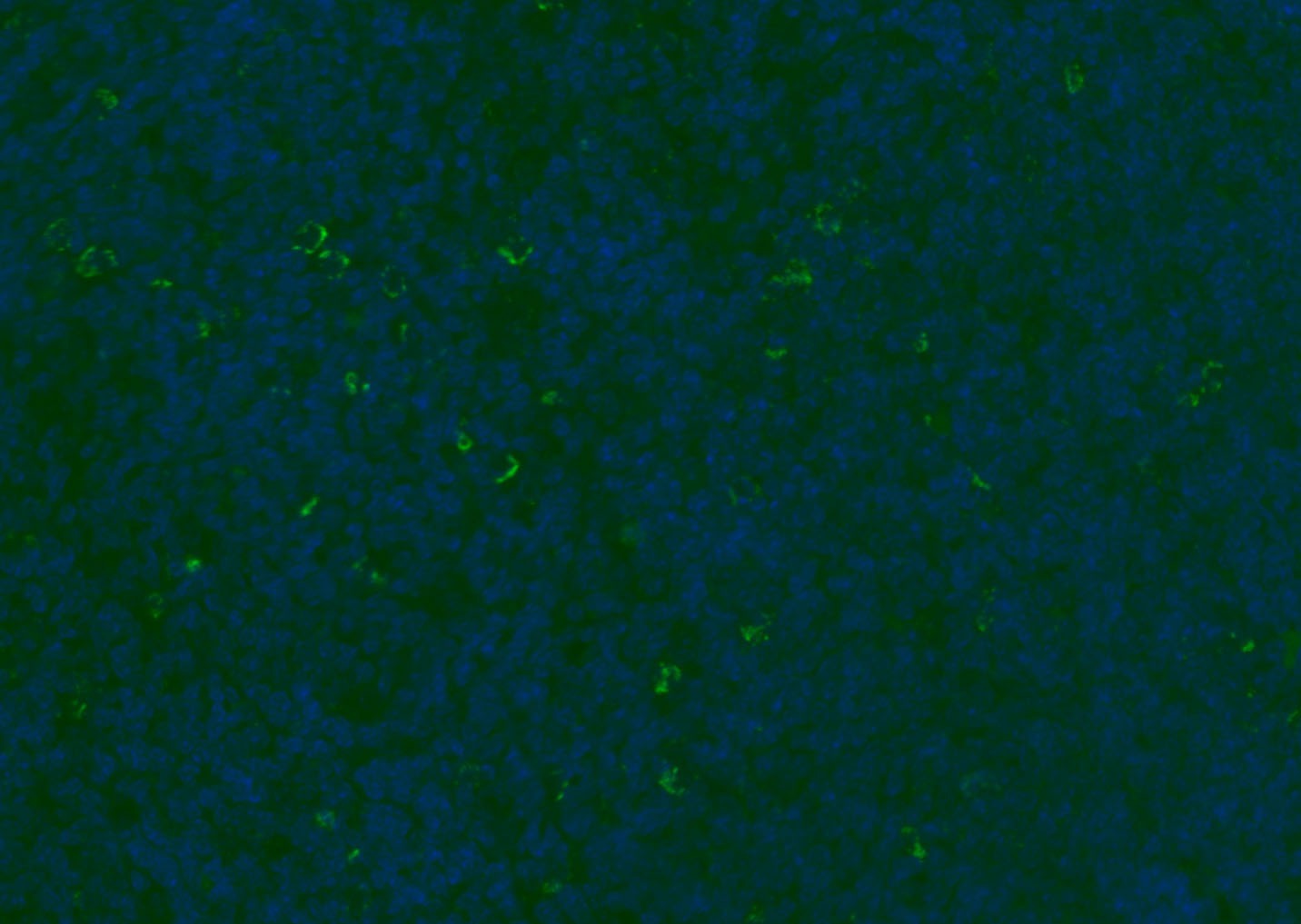Anti-CD8 beta Polyclonal Antibody