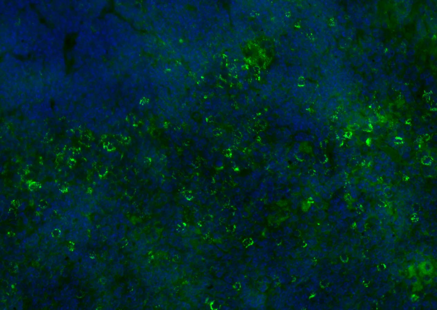 Anti-CD8 beta Polyclonal Antibody