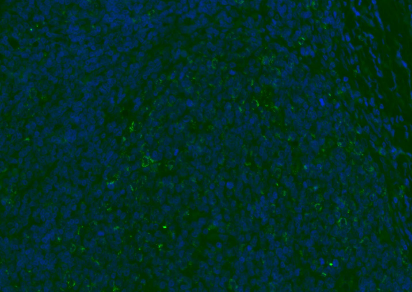 Anti-CD8 beta Polyclonal Antibody