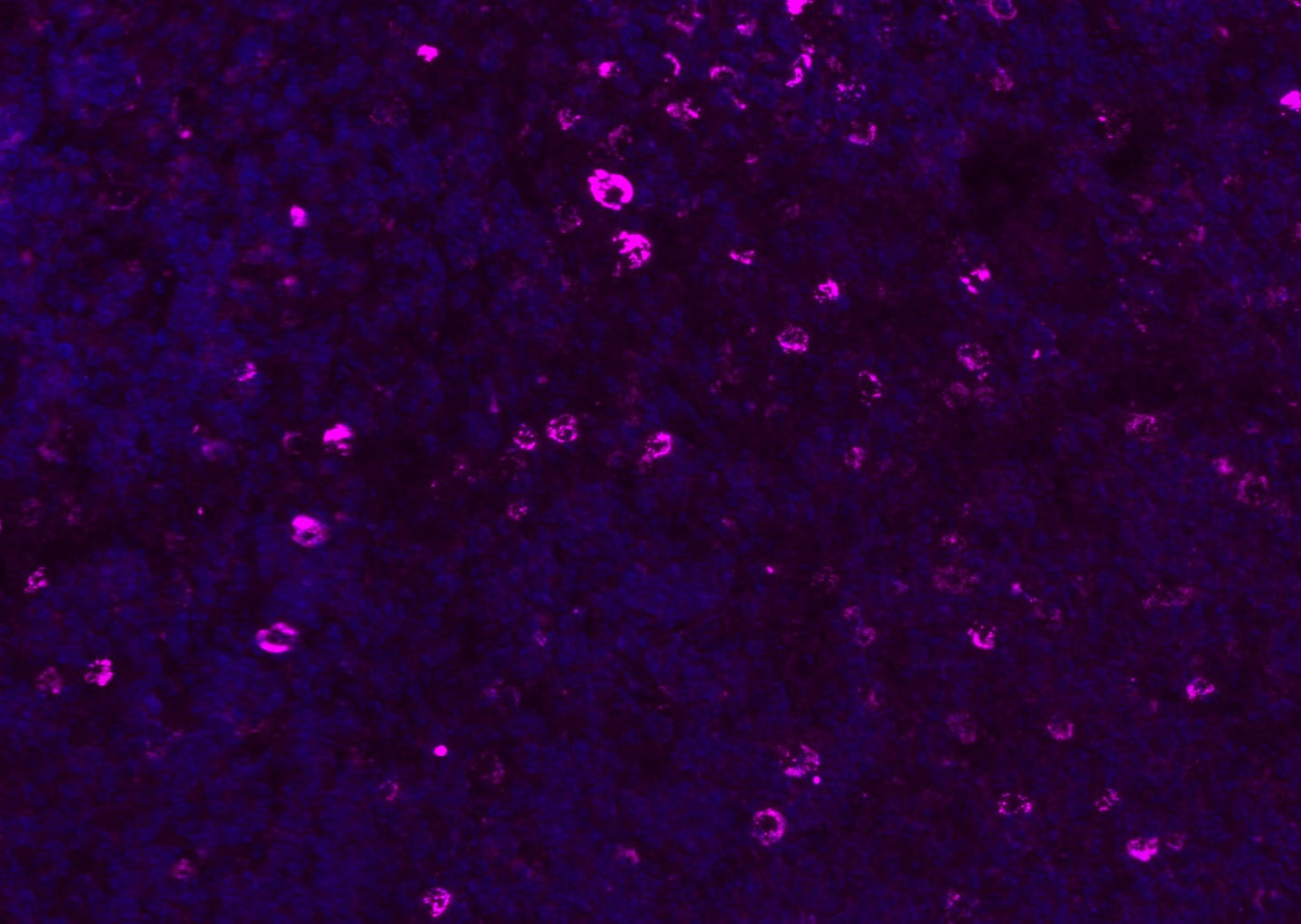 Anti-CD8 beta Polyclonal Antibody