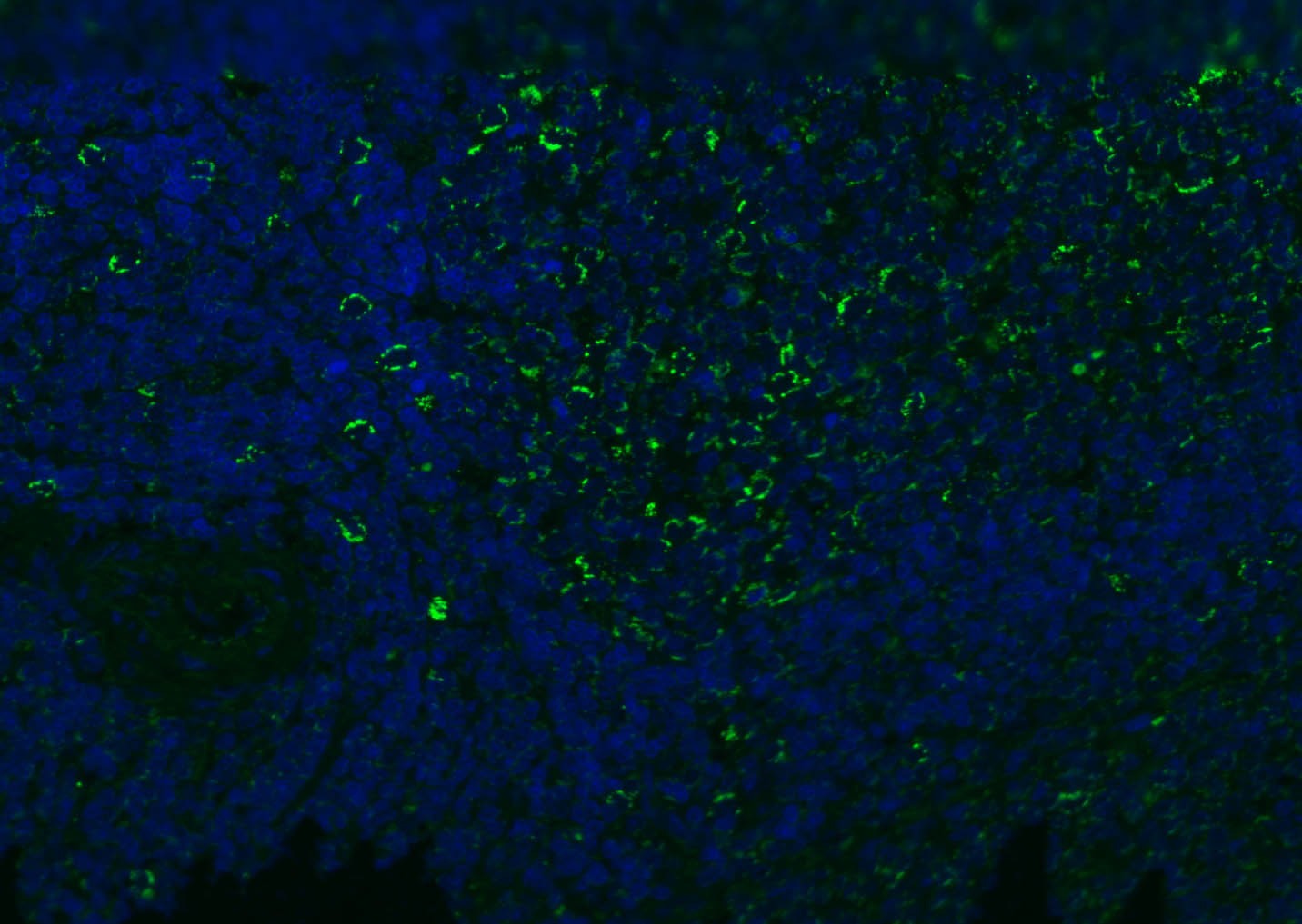 Anti-CD8 beta Polyclonal Antibody