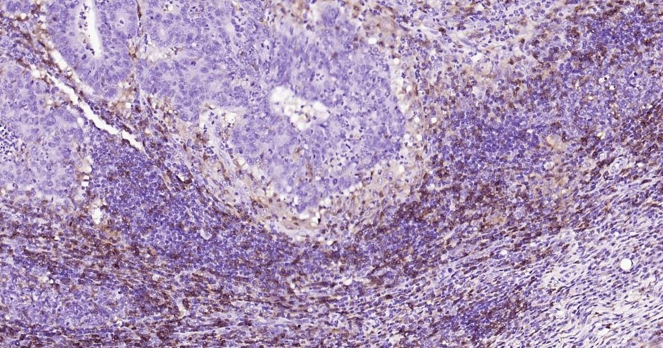 Anti-CD4 Antibody (8N971)