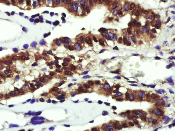 Anti-CCND1 Polyclonal Antibody 2