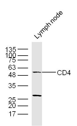 Anti-CD4 Polyclonal Antibody