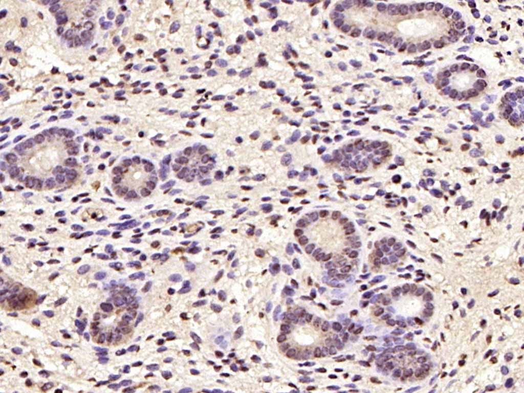 Anti-CCND1 Polyclonal Antibody 2